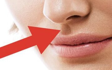 nhan-trung-ngan-va-sau